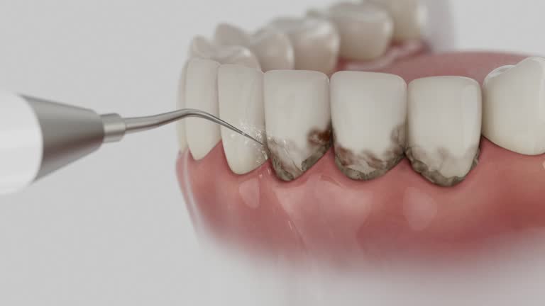 Reliable Dental Implants contractor in Mesa del Caballo, AZ by Smile Center Dentistry